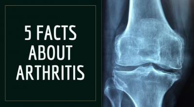 arthritis